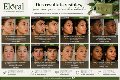Eloral – Savon Purifiant & Apaisant aux Ingrédients Naturels