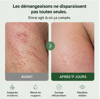 Eloral – Savon Purifiant & Apaisant aux Ingrédients Naturels